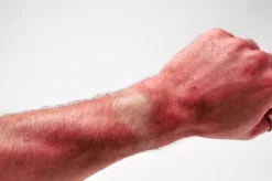 maekup - SUNBURN SPRAY 50ml